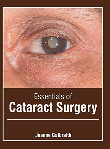 Essentials of Cataract Surgery [Hardcover]