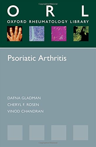 Psoriatic Arthritis [Paperback]