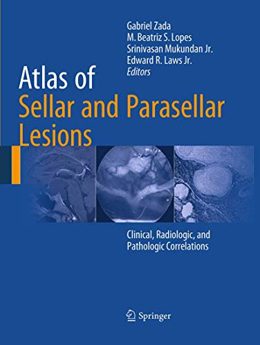 Atlas of Sellar and Parasellar Lesions: Clinical, Radiologic, and Pathologic Cor [Paperback]