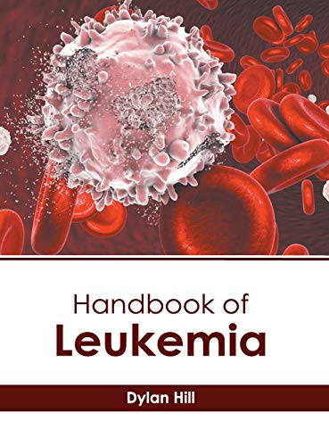 Handbook of Leukemia [Hardcover]