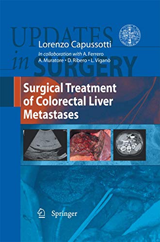 Surgical Treatment of Colorectal Liver Metastases [Paperback]