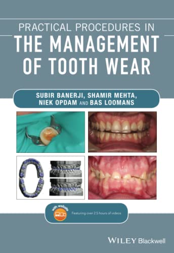 Practical Procedures in the Management of Tooth Wear [Paperback]