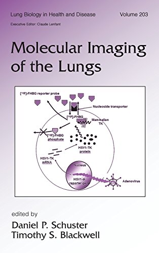 Molecular Imaging of the Lungs [Hardcover]