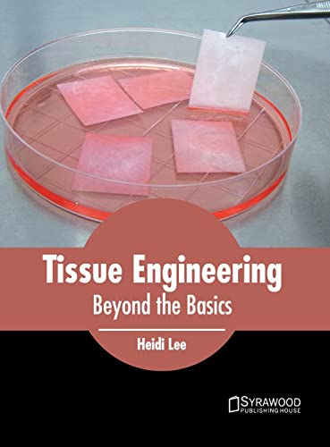 Tissue Engineering Beyond the Basics [Hardcover]