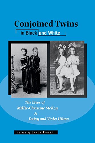 Conjoined Tins in Black and White The Lives of Millie-Christine McKoy and Dais [Paperback]