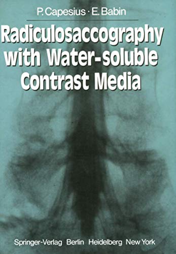 Radiculosaccography with Water-soluble Contrast Media [Paperback]