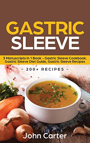 Gastric Sleeve [Hardcover]