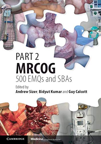 Part 2 MRCOG: 500 EMQs and SBAs [Paperback]