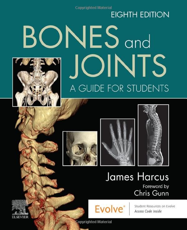 Bones and Joints: A Guide for Students [Paperback]