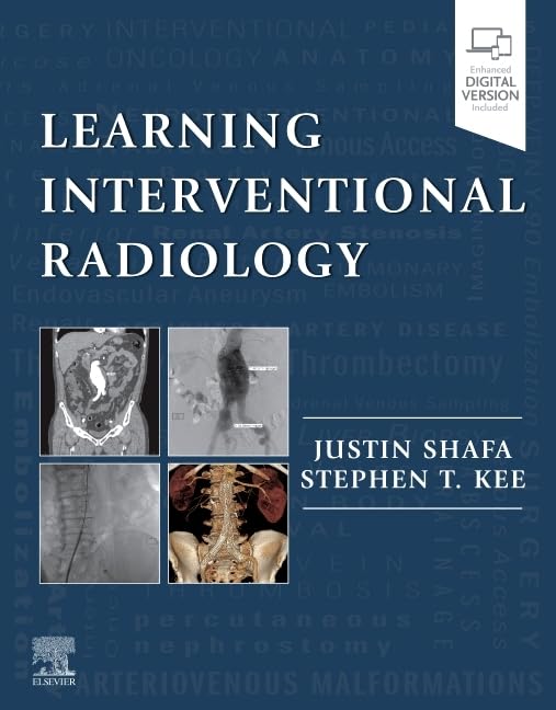 Learning Interventional Radiology [Paperback]