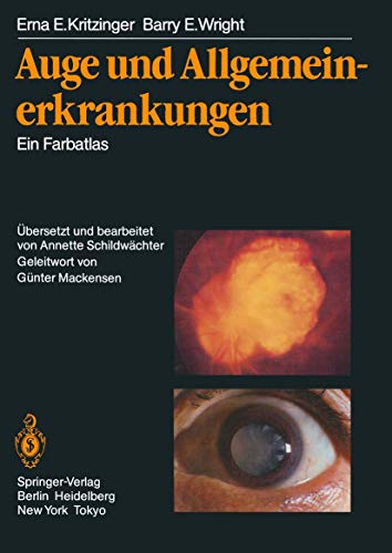 Auge und Allgemeinerkrankungen Ein Farbatlas [Paperback]