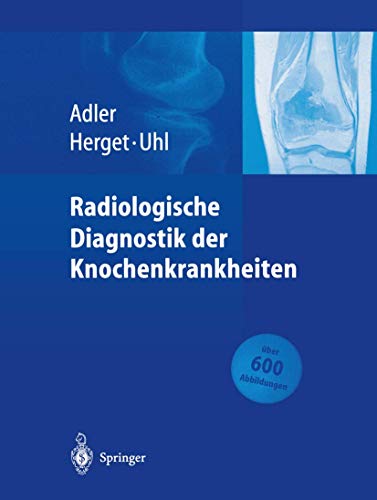 Radiologische Diagnostik der Knochenkrankheiten [Paperback]