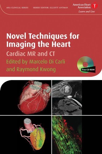 Novel Techniques for Imaging the Heart: Cardiac MR and CT [Hardcover]