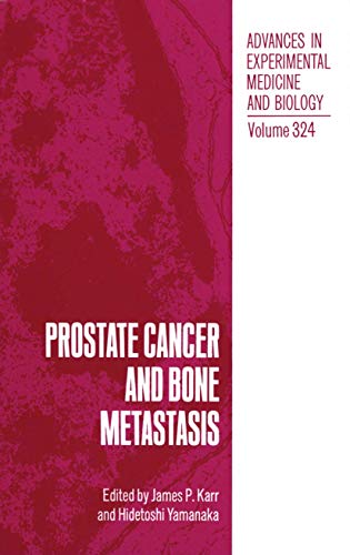 Prostate Cancer and Bone Metastasis [Paperback]