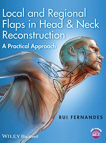 Local and Regional Flaps in Head and Neck Reconstruction: A Practical Approach [Hardcover]