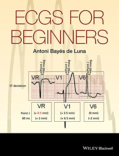 ECGs for Beginners [Paperback]