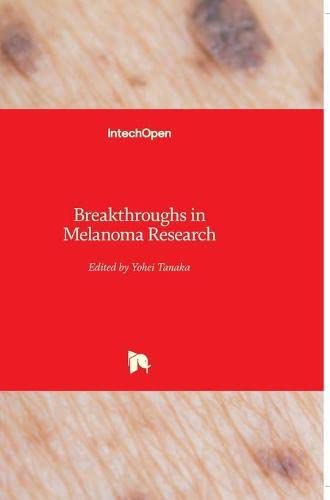 Breakthroughs In Melanoma Research