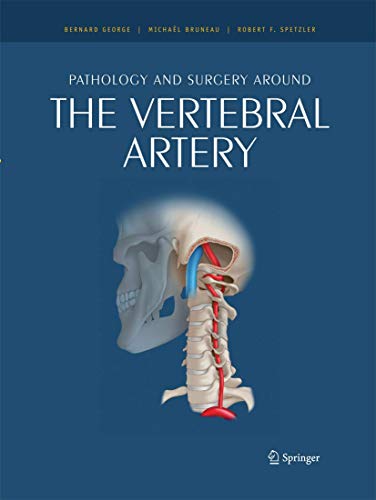 Pathology and surgery around the vertebral artery [Paperback]