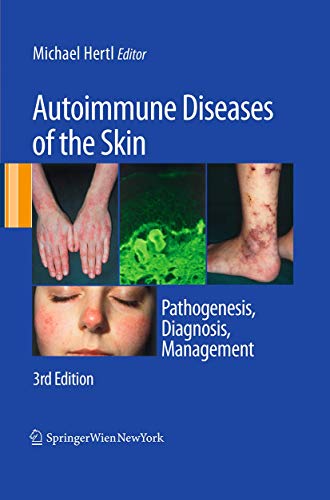 Autoimmune Diseases of the Skin Pathogenesis, Diagnosis, Management [Paperback]