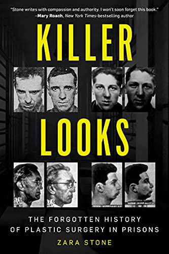 Killer Looks: The Forgotten History of Plastic Surgery in Prisons [Hardcover]