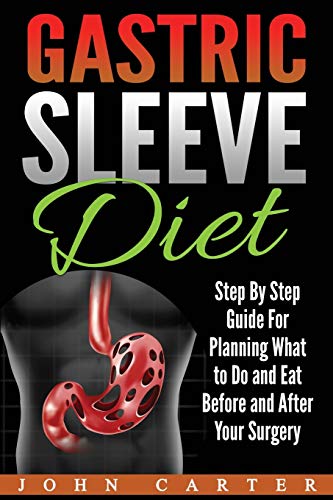 Gastric Sleeve Diet [Paperback]