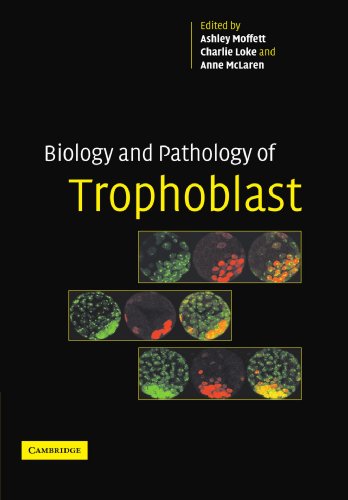 Biology and Pathology of Trophoblast [Paperback]