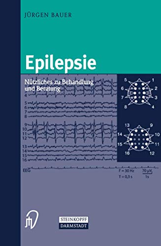 Epilepsie: Ntzliches zu Behandlung und Beratung [Paperback]