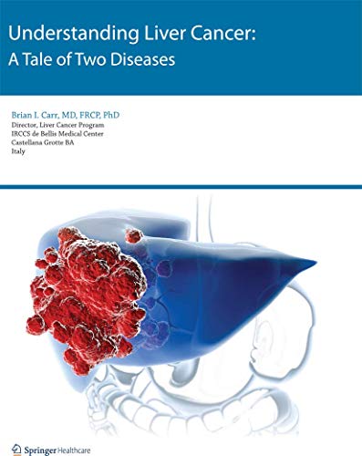 Understanding Liver Cancer: A Tale of Two Diseases [Paperback]