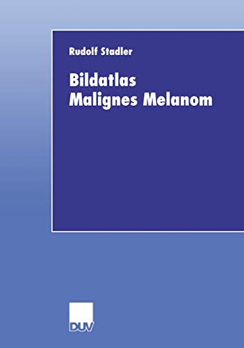 Bildatlas Malignes Melanom [Paperback]