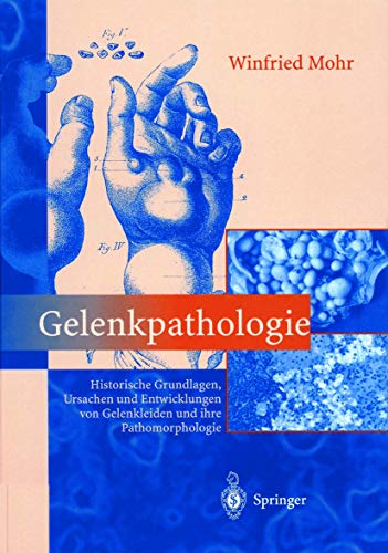 Gelenkpathologie Historische Grundlagen, Ursachen und Enticklungen von Gelenkl [Paperback]