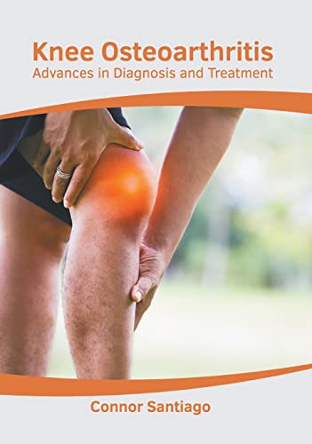 Knee Osteoarthritis Advances in Diagnosis and Treatment [Hardcover]