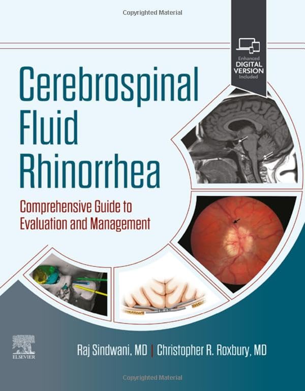 Cerebrospinal Fluid Rhinorrhea: Comprehensive Guide to Evaluation and Management [Hardcover]