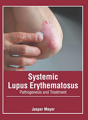 Systemic Lupus Erythematosus Pathogenesis and Treatment [Hardcover]