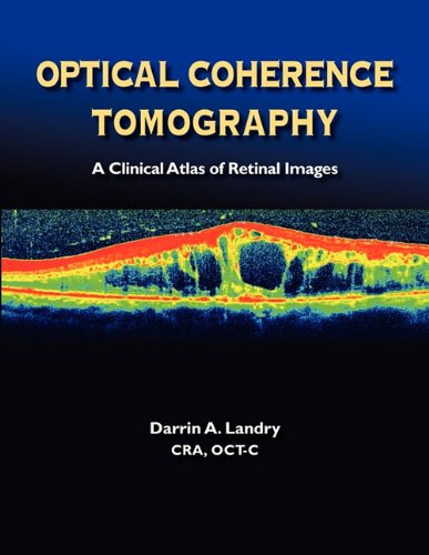 Optical Coherence Tomography A Clinical Atlas Of Retinal Images [Paperback]