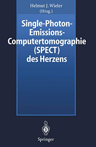 Single-Photon-Emissions-Computertomographie (SPECT) des Herzens [Paperback]