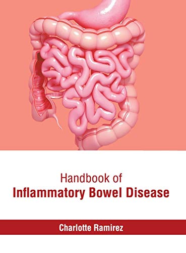 Handbook of Inflammatory Boel Disease [Hardcover]