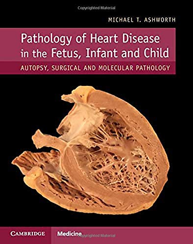 Pathology of Heart Disease in the Fetus, Infant and Child Autopsy, Surgical and [Hardcover]