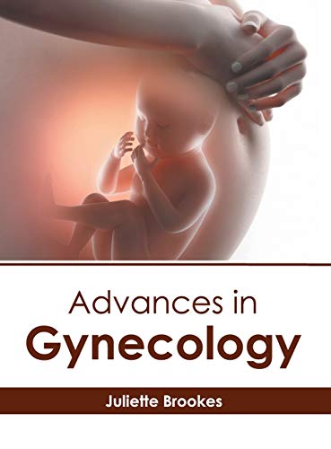 Advances in Gynecology [Hardcover]