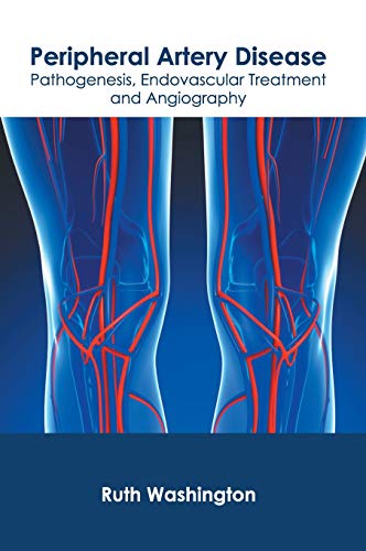 Peripheral Artery Disease Pathogenesis, Endovascular Treatment and Angiography [Hardcover]