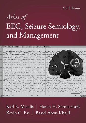 Atlas of EEG, Seizure Semiology, and Management [Hardcover]