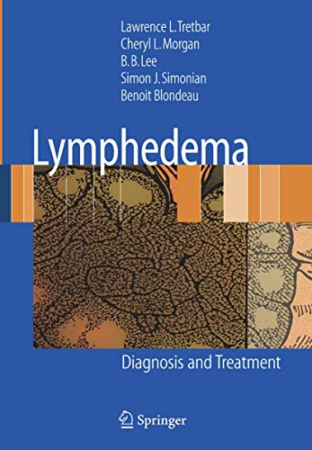 Lymphedema Diagnosis and Treatment [Hardcover]