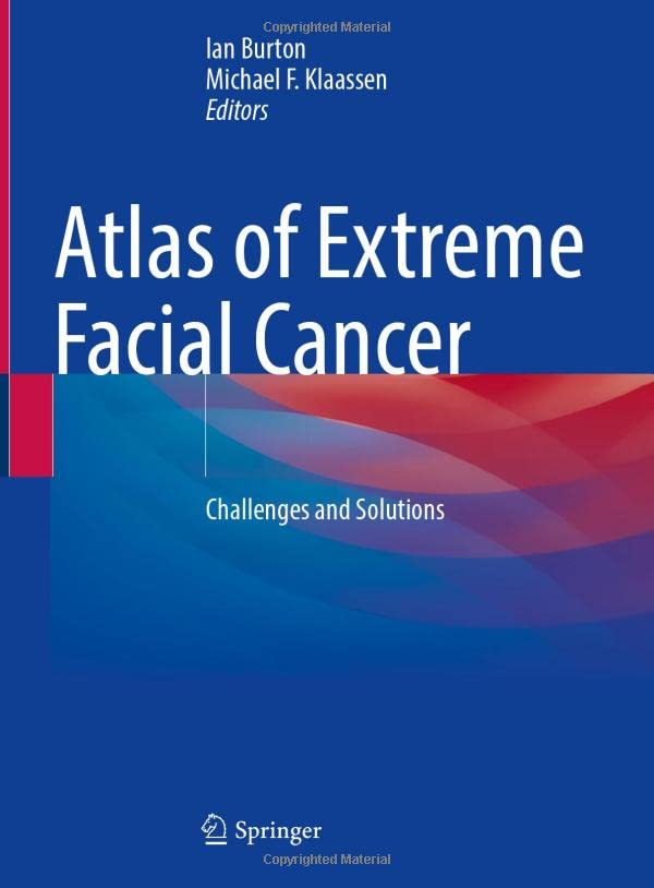 Atlas of Extreme Facial  Cancer: Challenges and Solutions [Hardcover]