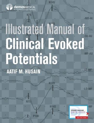 Illustrated Manual of Clinical Evoked Potentials [Hardcover]