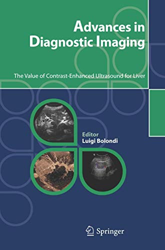 Advances in Diagnostic Imaging: The Value of Contrast-Enhanced Ultrasound for Li [Paperback]