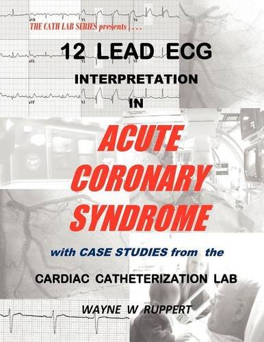 12 Lead Ecg Interpretation In Acute Coronary Syndrome With Case Studies From The [Paperback]