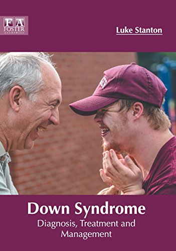 Don Syndrome Diagnosis, Treatment and Management [Hardcover]