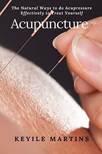 Acupuncture  The Natural Ways to Do Acupressure Effectively to Treat Yourself [Paperback]