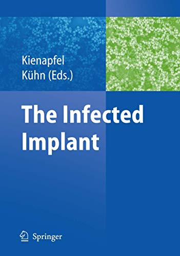 The Infected Implant [Paperback]