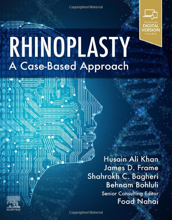 Rhinoplasty: a Case-based approach [Hardcover]