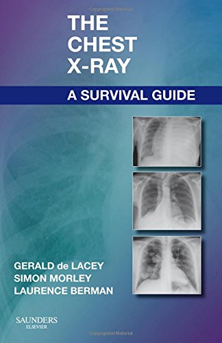 The Chest X-Ray: A Survival Guide [Paperback]